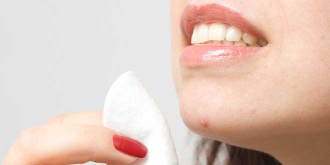 Garlic to treat the acne