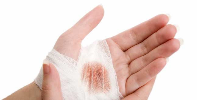 Wound-healing Horsetail