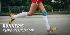 Runners knee syndrome