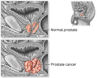 Prostate anatomical drawing Prostate anatomical drawing