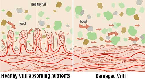 Healthy and unhealthy villi