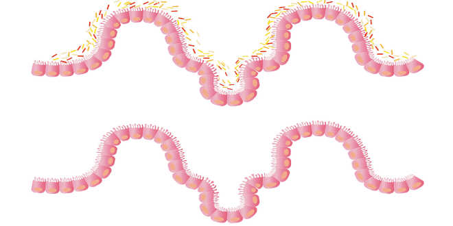 The villi from the small intestine The villi from the small intestine