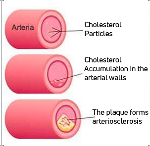 Beta-glucans against cholesterol