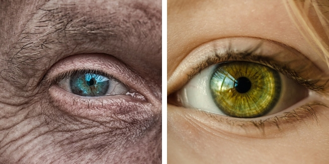 Wrinkles and cell aging