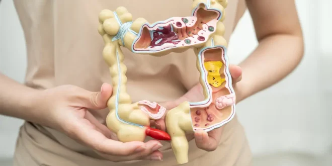Things that damage the intestinal flora Things that damage the intestinal flora