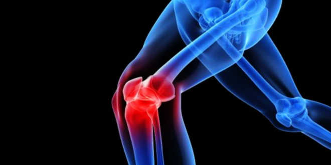Knee pain