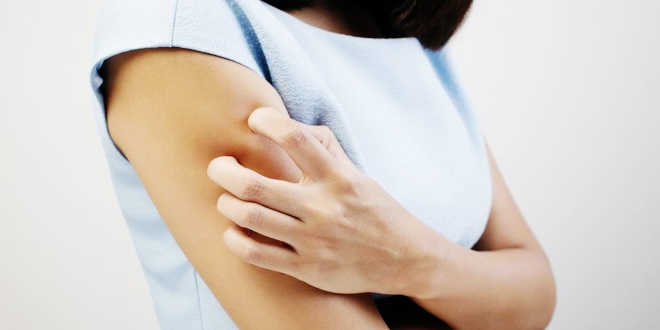 Woman scratching her arm