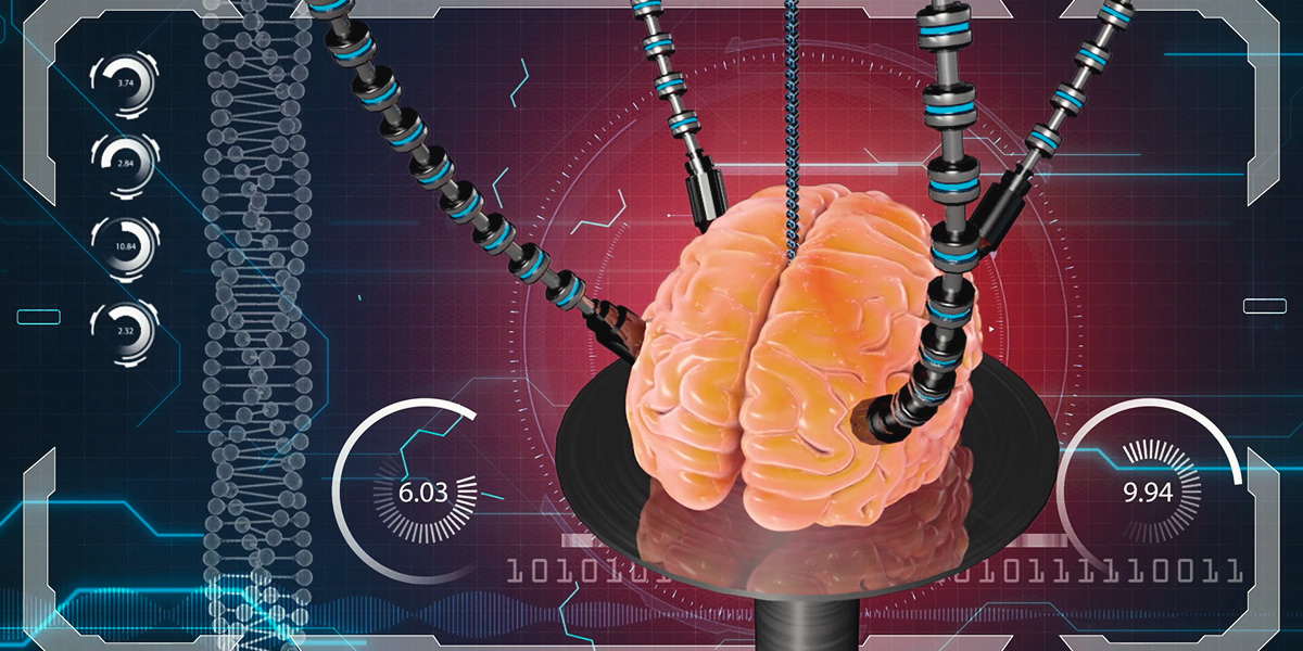 Brain Brain