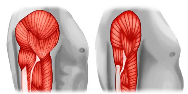 Sarcopenia Sarcopenia