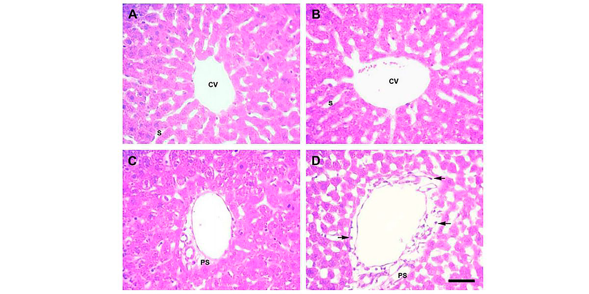 Hepatic lobe
