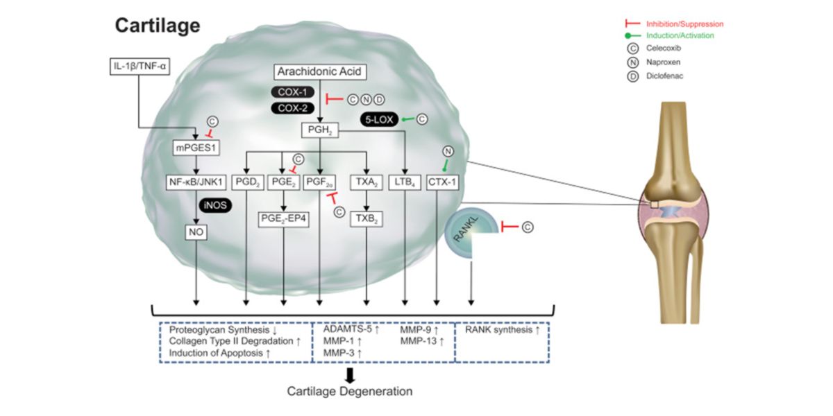 Cartilage degeneration Cartilage degeneration