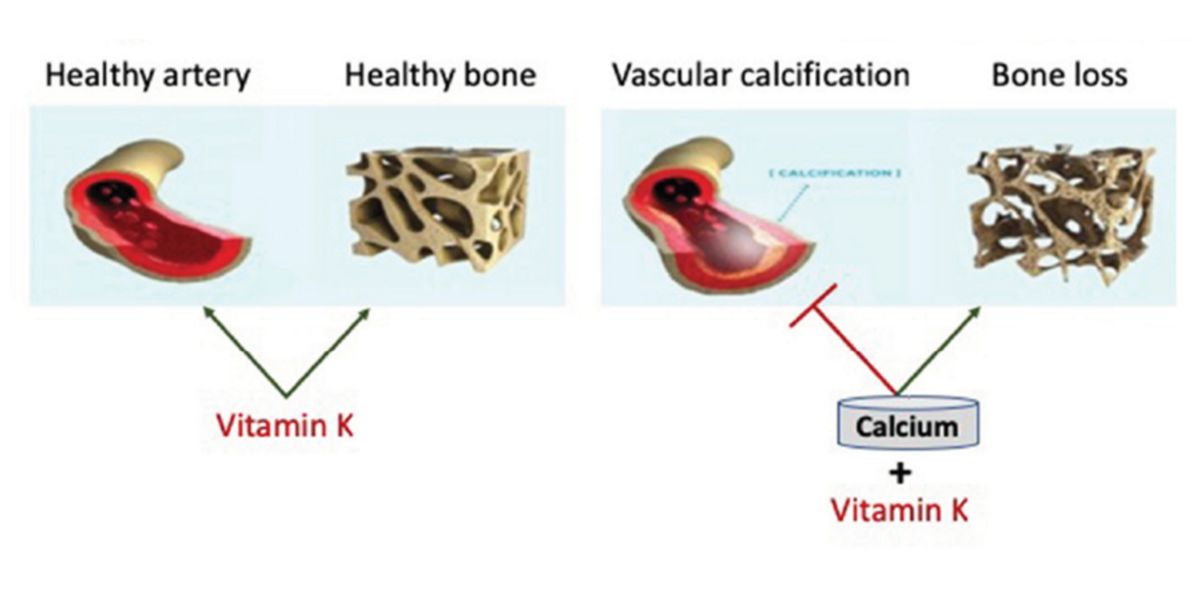 Bone vascular health Bone vascular health