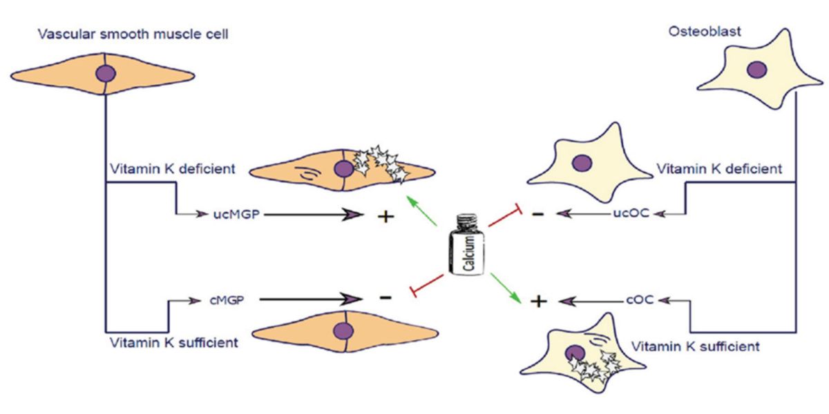 Calcification muscle Calcification muscle