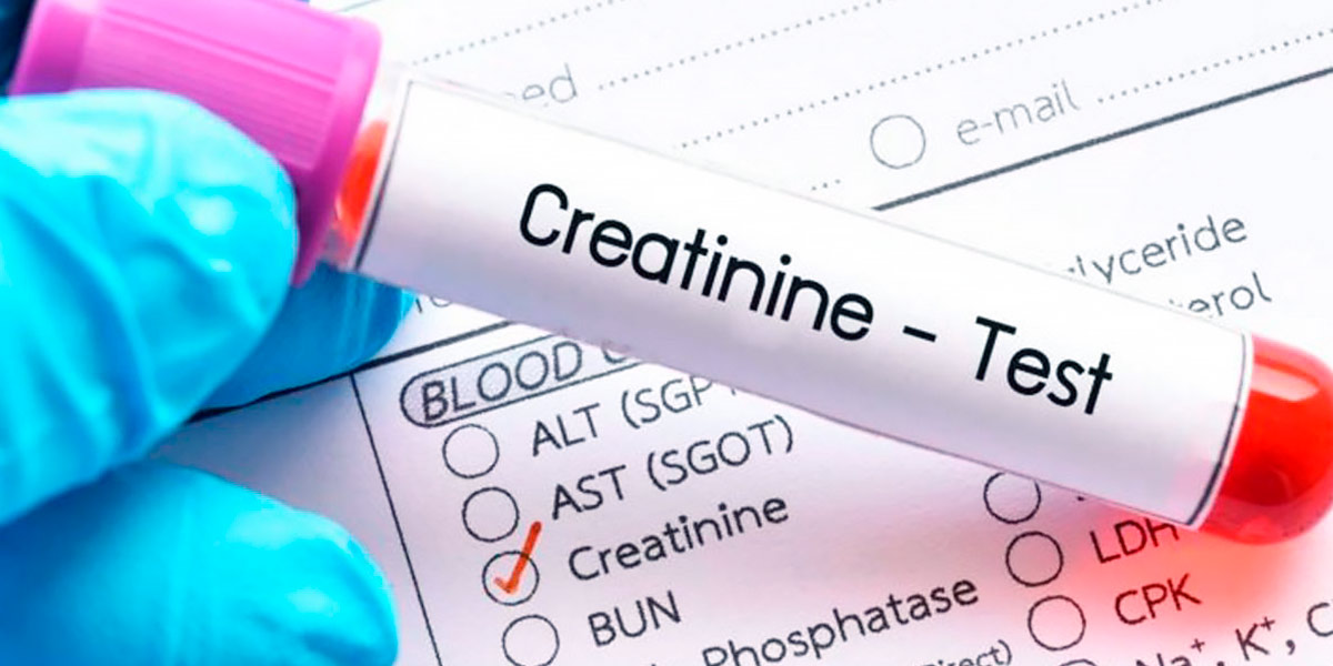 Creatinine
