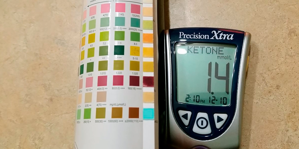 Ketonemia meter Ketonemia meter