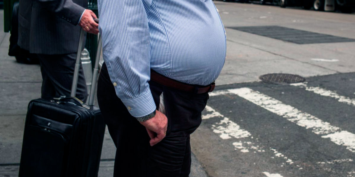 Obesity Obesity