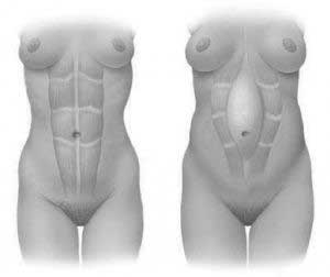 Abdomen Abdomen