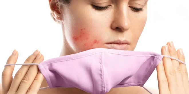 What is maskne and how can I treat it?