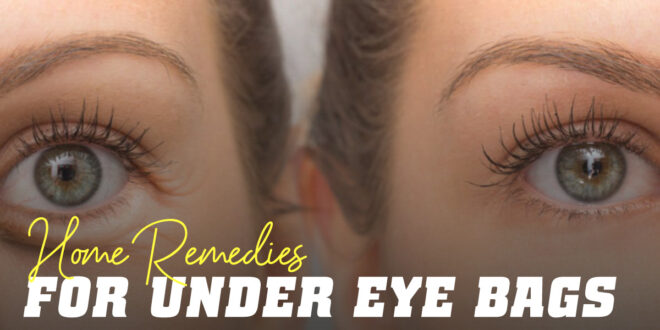 A Look at Dark Eye Circles: We tell you the Best Home Remedies
