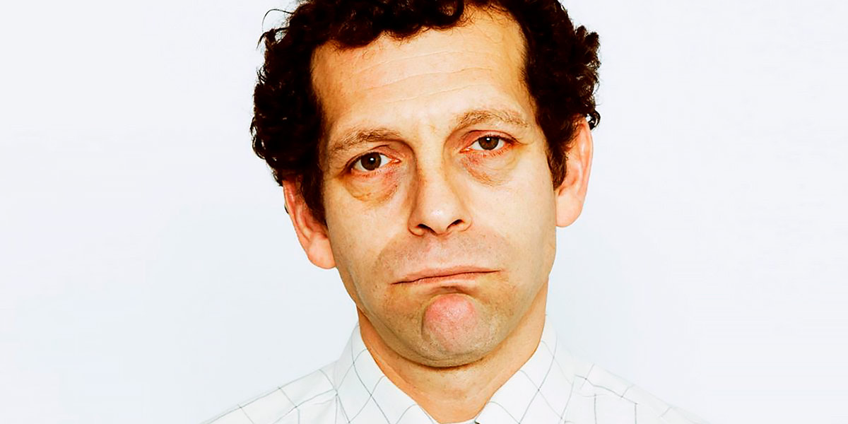 Under Eye Bags