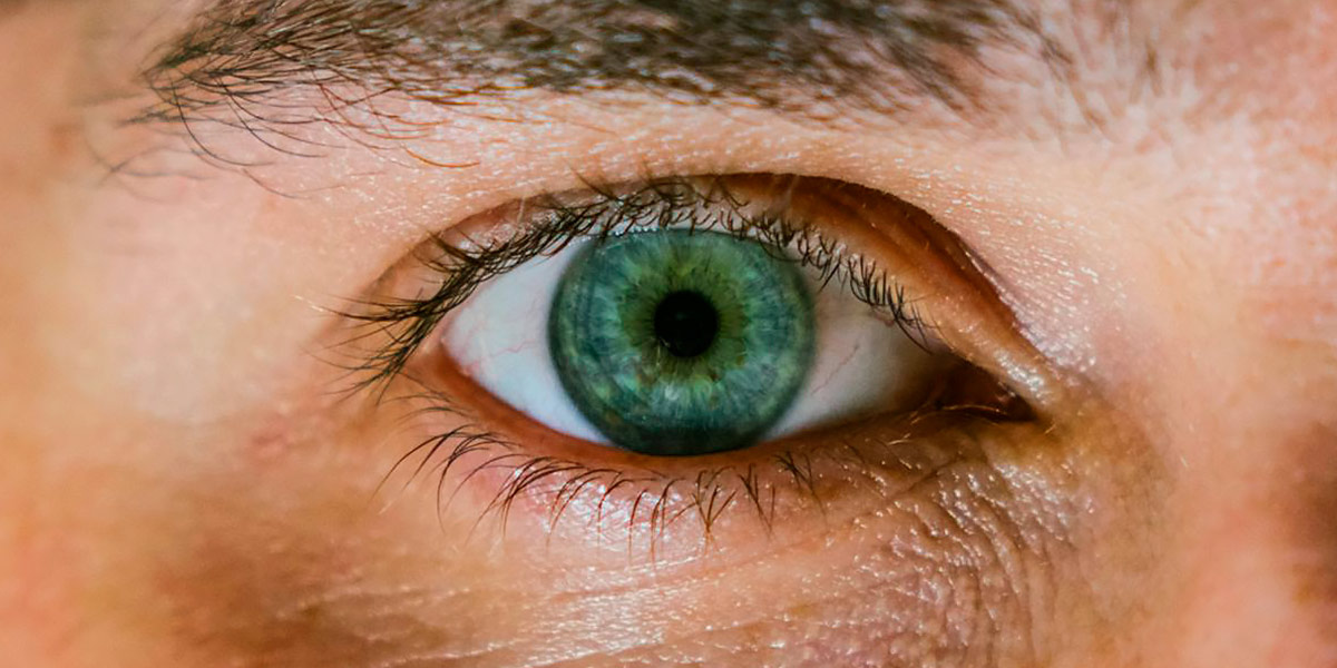 What are dark circles under the eyes