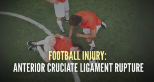 The most feared injury in Football: Anterior Cruciate Ligament