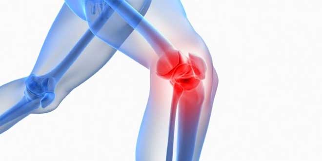 SAMe and osteoarthritis SAMe and osteoarthritis