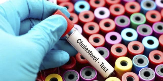 Test Cholesterol Test Cholesterol