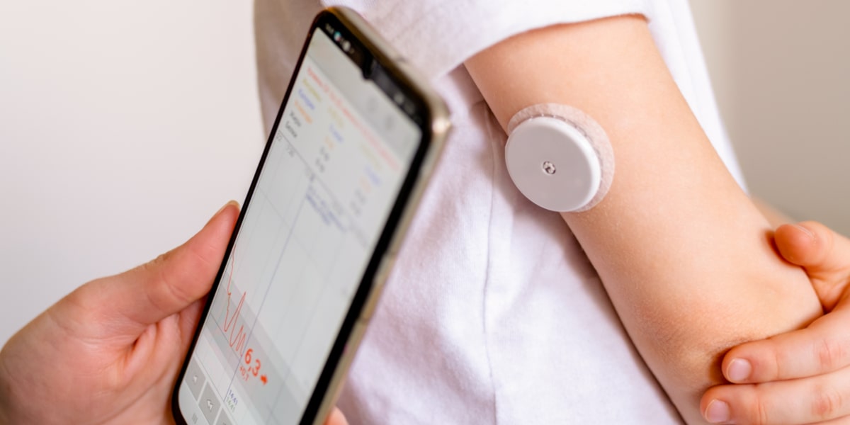 glucose sensor glucose sensor