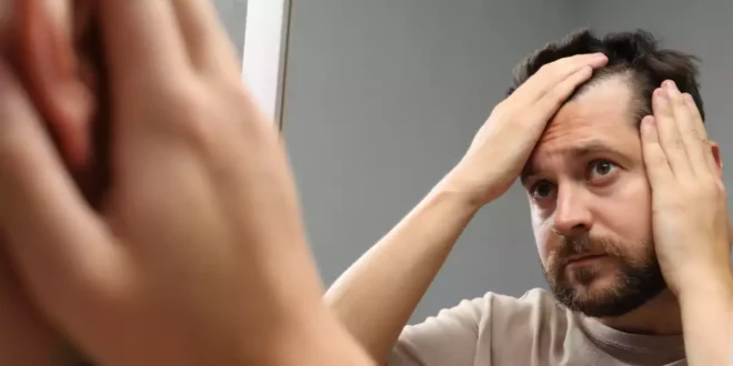 How to Treat Alopecia and Prevent Hair Loss