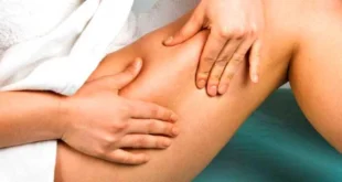 Cellulite: what it is, why it happens in women, causes, how to get rid of it