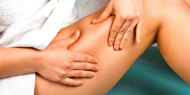 Cellulite: what it is, why it happens in women, causes, how to get rid of it Cellulite: what it is, why it happens in women, causes, how to get rid of it