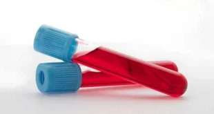 Rare parameters in blood tests when using steroids