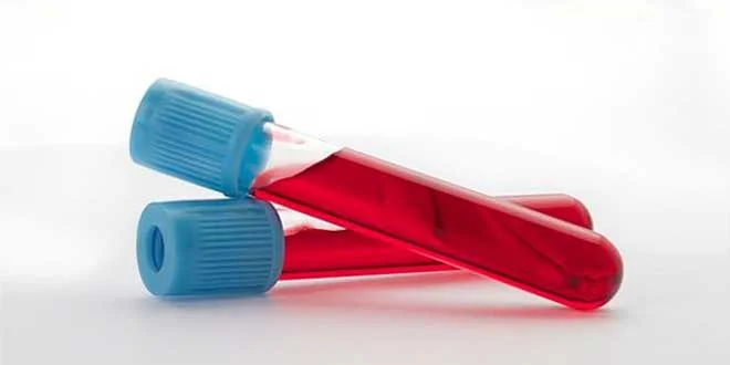 Rare parameters in blood tests when using steroids Rare parameters in blood tests when using steroids