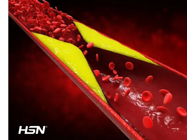 Cholesterol influence 